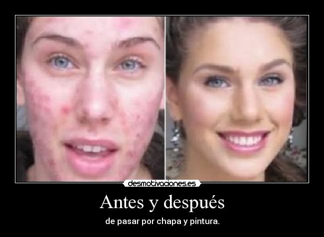 Antes y después - de pasar por chapa y pintura.