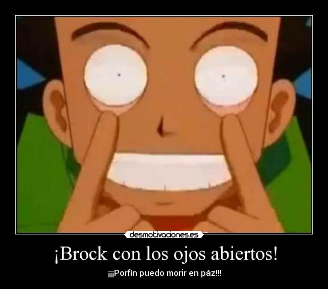 ¡Brock con los ojos abiertos! - ¡¡¡Porfín puedo morir en páz!!!
