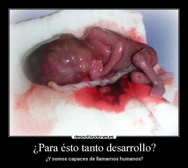 ¿Para ésto tanto desarrollo? - ¿Y somos capaces de llamarnos humanos?