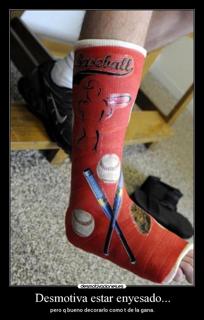 Desmotiva estar enyesado... - pero q bueno decorarlo como t de la gana.