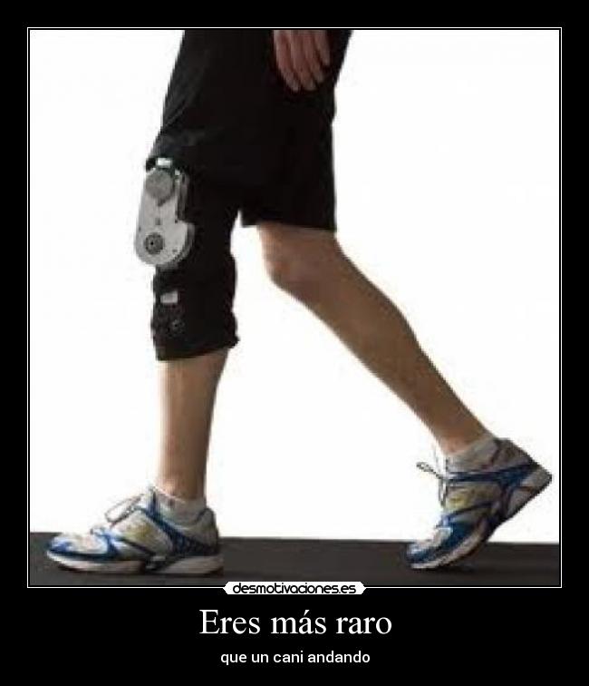 Eres más raro - que un cani andando