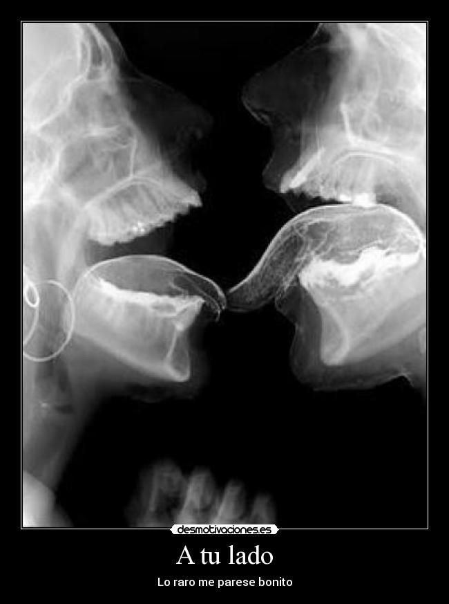 A tu lado - Lo raro me parese bonito