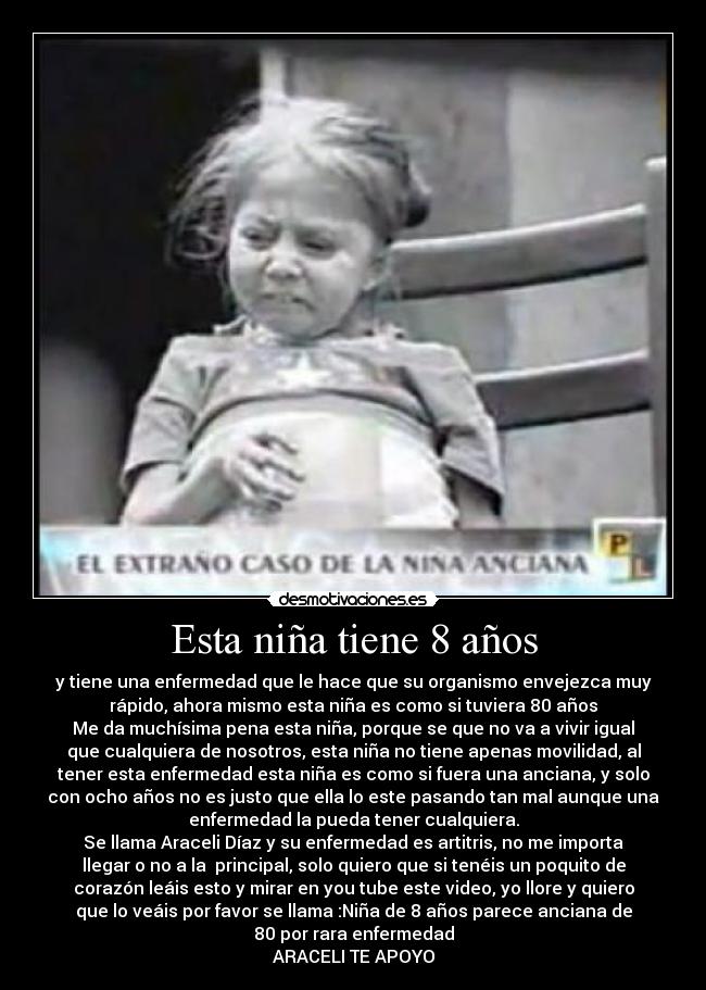 Esta niña tiene 8 años - y tiene una enfermedad que le hace que su organismo envejezca muy
rápido, ahora mismo esta niña es como si tuviera 80 años
Me da muchísima pena esta niña, porque se que no va a vivir igual
que cualquiera de nosotros, esta niña no tiene apenas movilidad, al
tener esta enfermedad esta niña es como si fuera una anciana, y solo
con ocho años no es justo que ella lo este pasando tan mal aunque una
enfermedad la pueda tener cualquiera.
Se llama Araceli Díaz y su enfermedad es artitris, no me importa
llegar o no a la principal, solo quiero que si tenéis un poquito de
corazón leáis esto y mirar en you tube este video, yo llore y quiero
que lo veáis por favor se llama :Niña de 8 años parece anciana de
80 por rara enfermedad
ARACELI TE APOYO