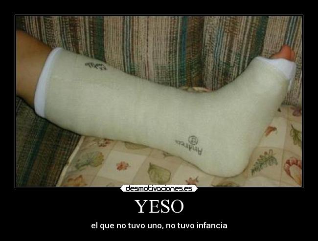 YESO - el que no tuvo uno, no tuvo infancia