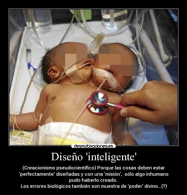 Diseño inteligente - (Creacionismo pseudocientífico) Porque las cosas deben estar
perfectamente diseñadas y con una misión,  sólo algo inhumano
pudo haberlo creado. 
Los errores biológicos también son muestra de poder divino...(?)
