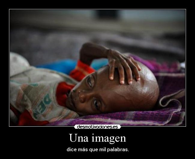 Una imagen - dice más que mil palabras.