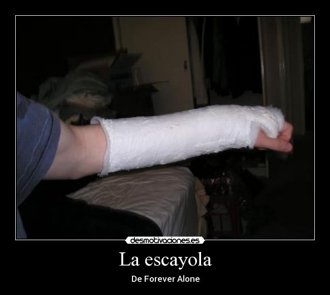 carteles yeso escayola fractura desmotiva desmotivaciones