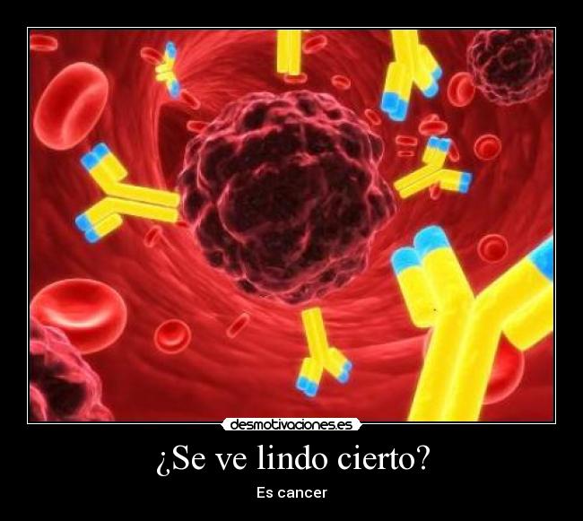 ¿Se ve lindo cierto? - Es cancer