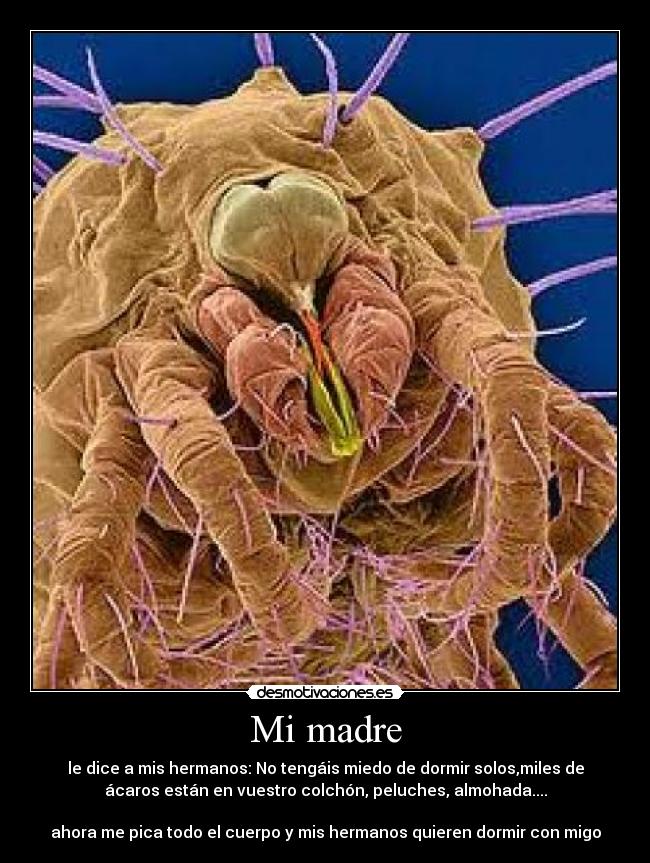 Mi madre - le dice a mis hermanos: No tengáis miedo de dormir solos,miles de
ácaros están en vuestro colchón, peluches, almohada....
ahora me pica todo el cuerpo y mis hermanos quieren dormir con migo