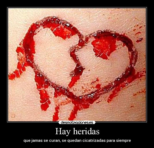 Hay heridas - que jamas se curan, se quedan cicatrizadas para siempre