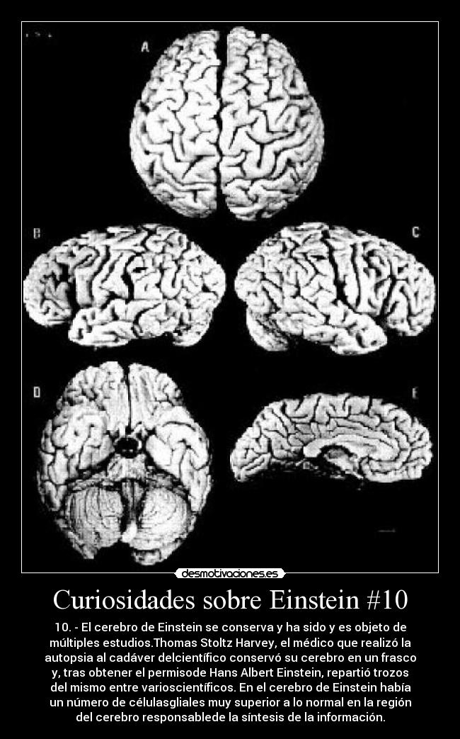 Curiosidades sobre Einstein #10 - 10. - El cerebro de Einstein se conserva y ha sido y es objeto de
múltiples estudios.Thomas Stoltz Harvey, el médico que realizó la
autopsia al cadáver delcientífico conservó su cerebro en un frasco
y, tras obtener el permisode Hans Albert Einstein, repartió trozos
del mismo entre varioscientíficos. En el cerebro de Einstein había
un número de célulasgliales muy superior a lo normal en la región
del cerebro responsablede la síntesis de la información.