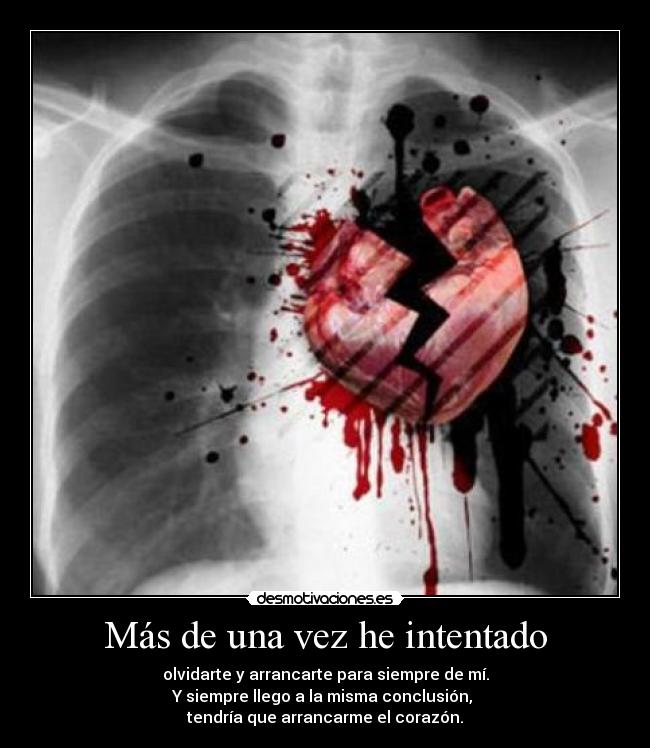 Más de una vez he intentado - olvidarte y arrancarte para siempre de mí.
Y siempre llego a la misma conclusión, 
tendría que arrancarme el corazón.