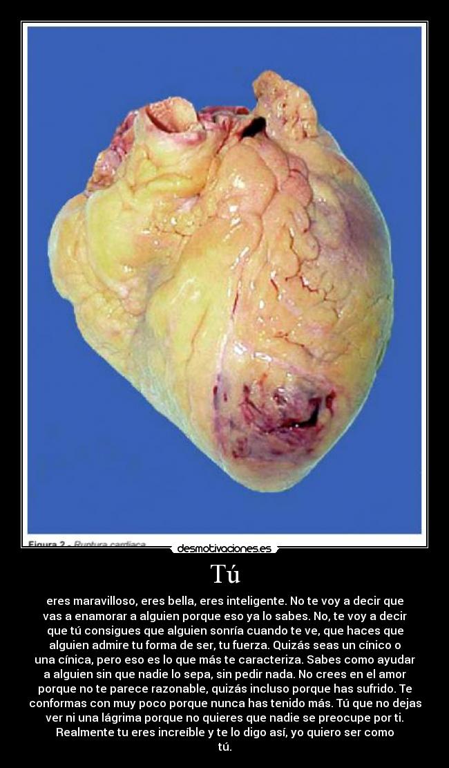 Tú - eres maravilloso, eres bella, eres inteligente. No te voy a decir que
vas a enamorar a alguien porque eso ya lo sabes. No, te voy a decir
que tú consigues que alguien sonría cuando te ve, que haces que
alguien admire tu forma de ser, tu fuerza. Quizás seas un cínico o
una cínica, pero eso es lo que más te caracteriza. Sabes como ayudar
a alguien sin que nadie lo sepa, sin pedir nada. No crees en el amor
porque no te parece razonable, quizás incluso porque has sufrido. Te
conformas con muy poco porque nunca has tenido más. Tú que no dejas
ver ni una lágrima porque no quieres que nadie se preocupe por ti.
Realmente tu eres increíble y te lo digo así, yo quiero ser como
tú.