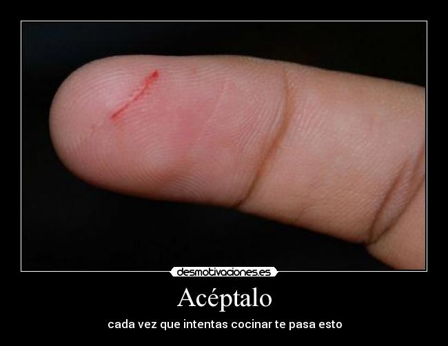 Acéptalo -