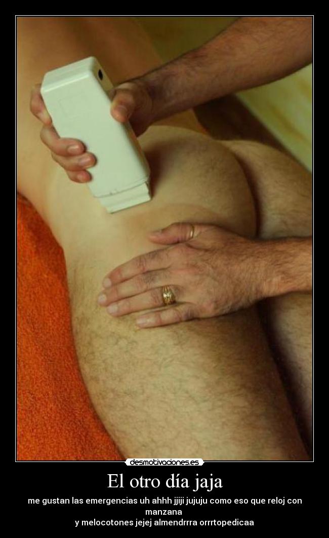 El otro día jaja - 