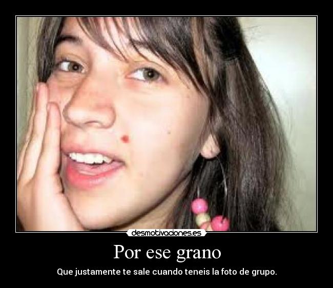 Por ese grano - Que justamente te sale cuando teneis la foto de grupo.