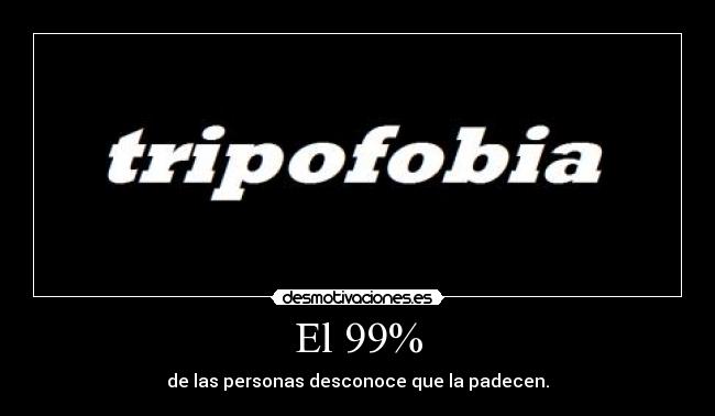 El 99% -