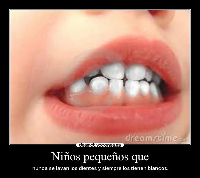 Niños pequeños que - nunca se lavan los dientes y siempre los tienen blancos.