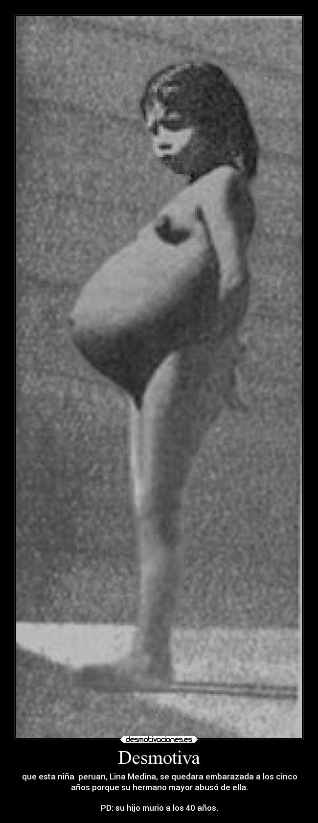 Desmotiva - que esta niña peruan, Lina Medina, se quedara embarazada a los cinco
años porque su hermano mayor abusó de ella.
PD: su hijo murio a los 40 años.
