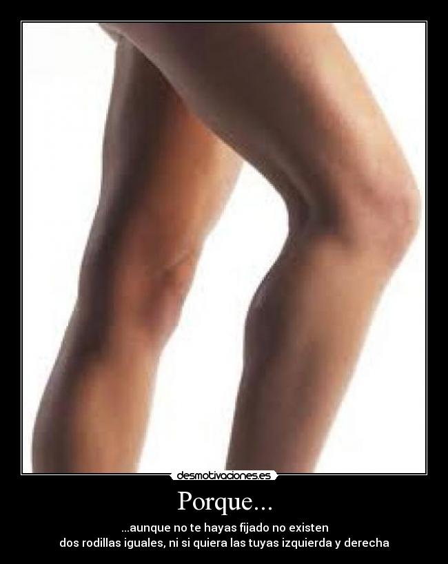 Porque... - ...aunque no te hayas fijado no existen
dos rodillas iguales, ni si quiera las tuyas izquierda y derecha
