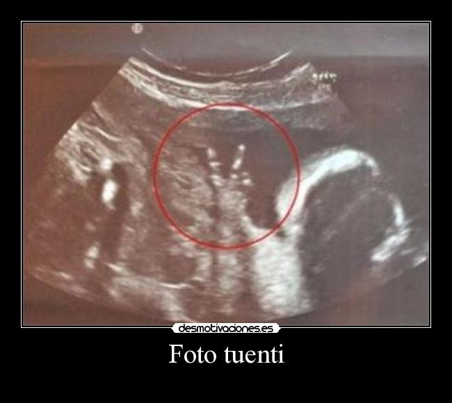 Foto tuenti -