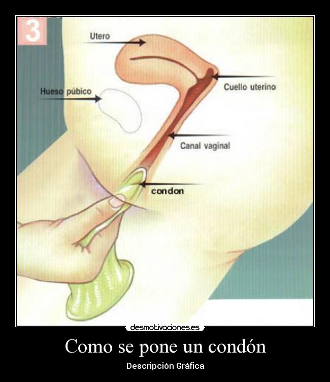 Como se pone un condón - 