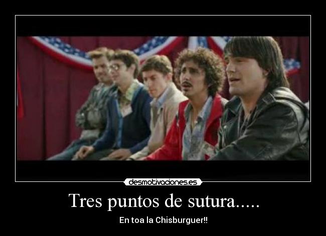 Tres puntos de sutura..... -