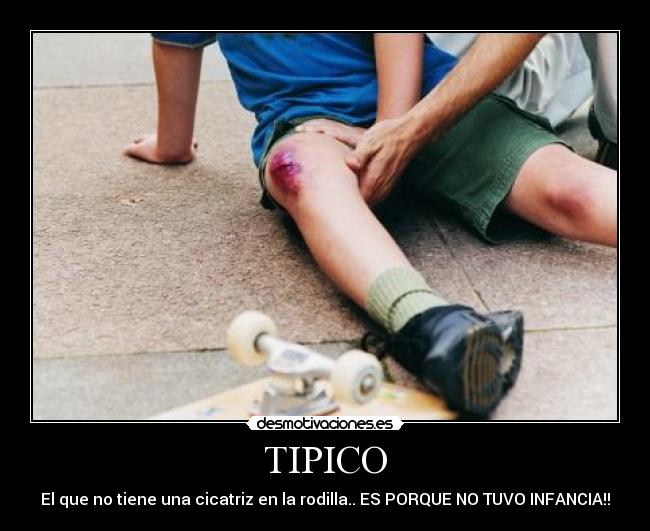TIPICO -