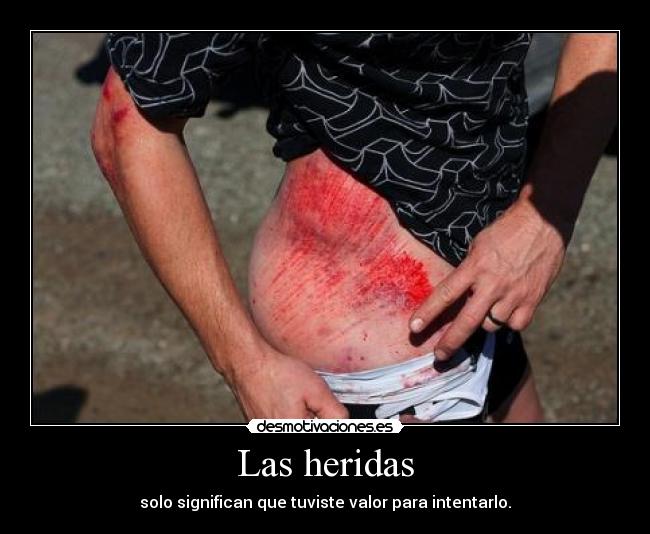 Las heridas -