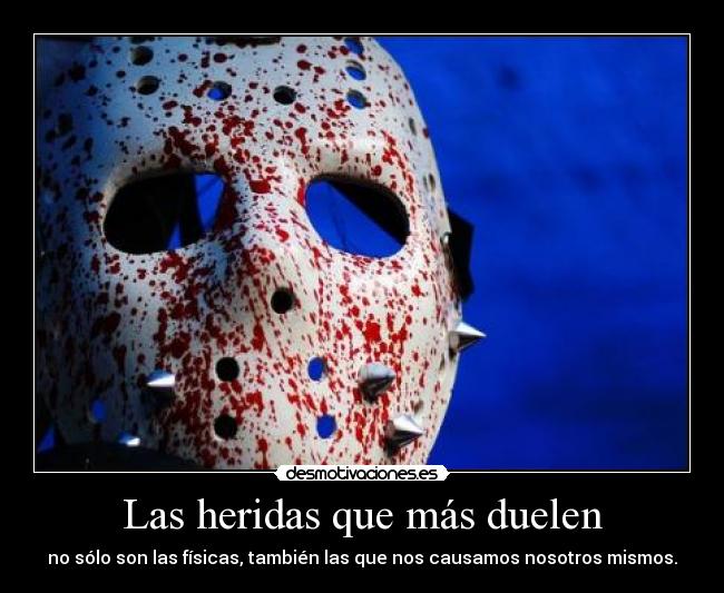 Las heridas que más duelen - no sólo son las físicas, también las que nos causamos nosotros mismos.