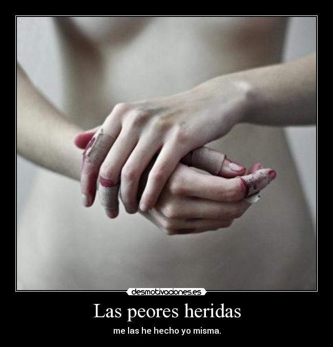 Las peores heridas - me las he hecho yo misma.