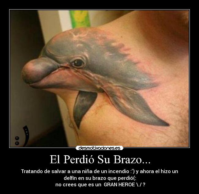 El Perdió Su Brazo... - 