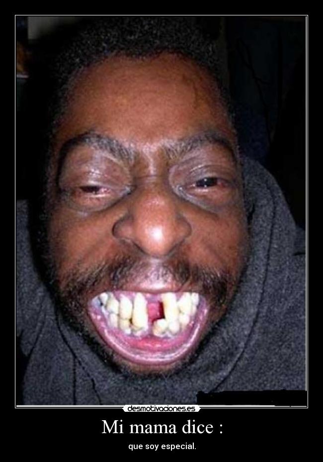 Mi mama dice : - que soy especial.