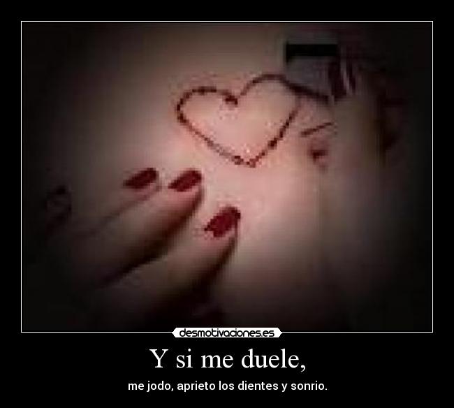 Y si me duele, - 