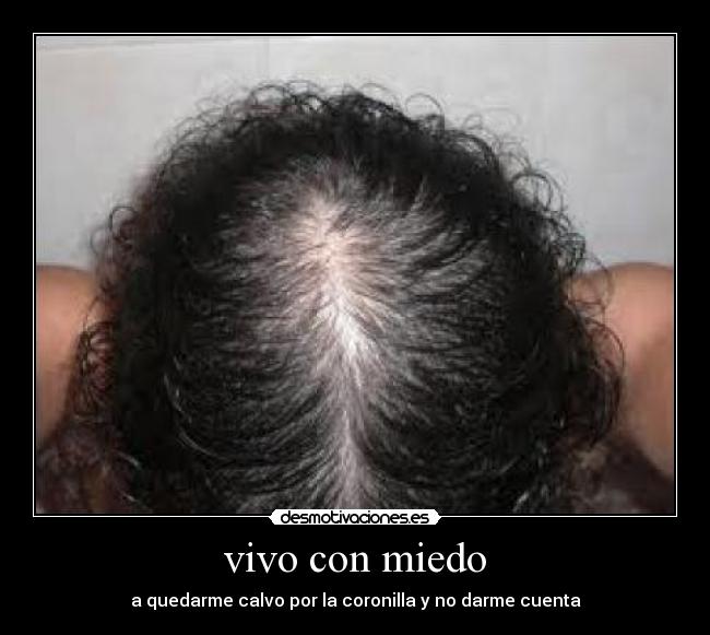 vivo con miedo - a quedarme calvo por la coronilla y no darme cuenta