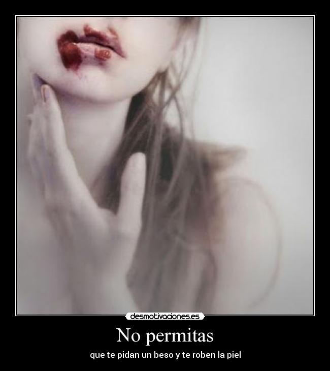 No permitas - que te pidan un beso y te roben la piel