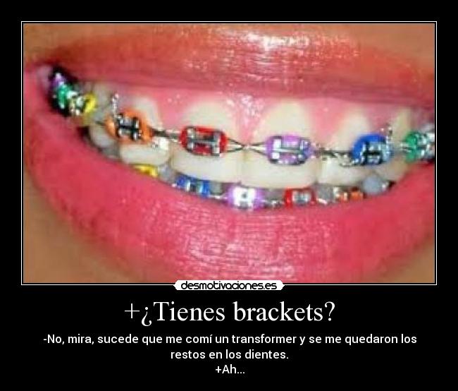 +¿Tienes brackets? -