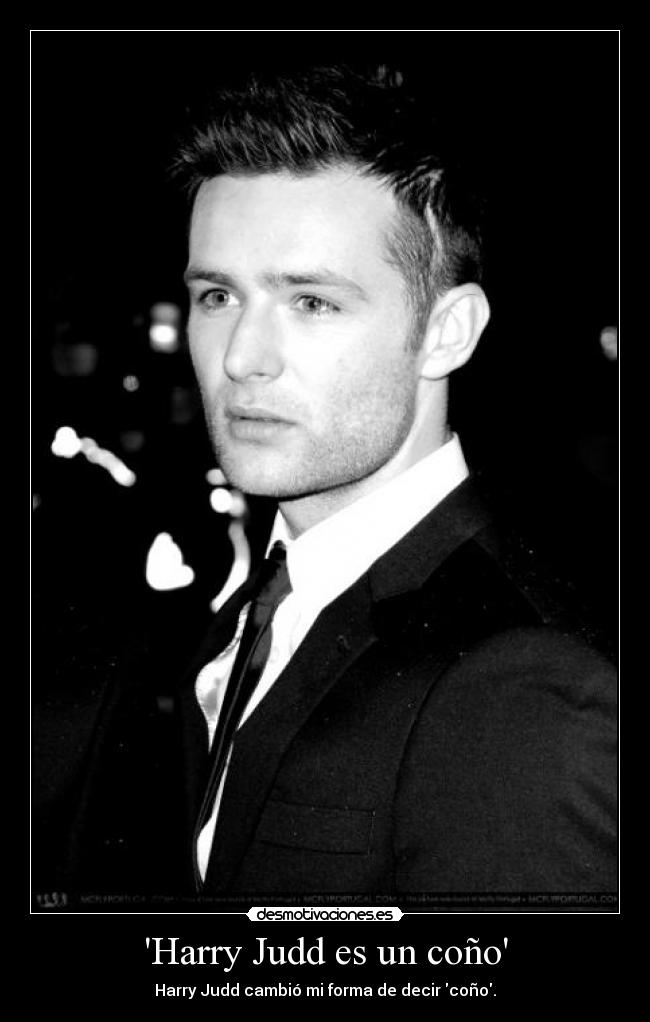 Harry Judd es un coño - 