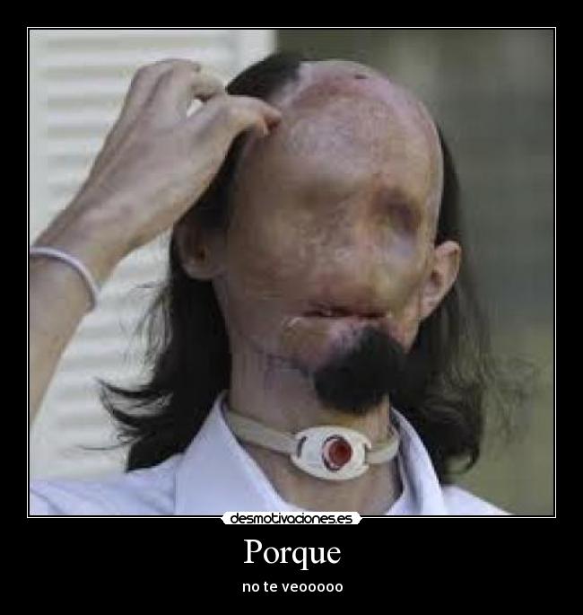 Porque - no te veooooo