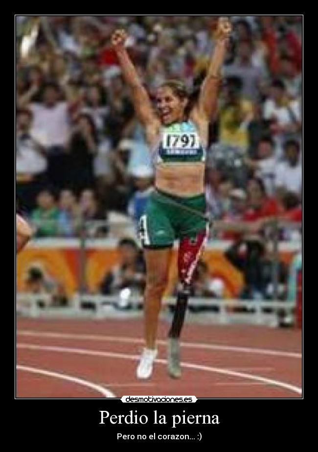 Perdio la pierna - Pero no el corazon... :)