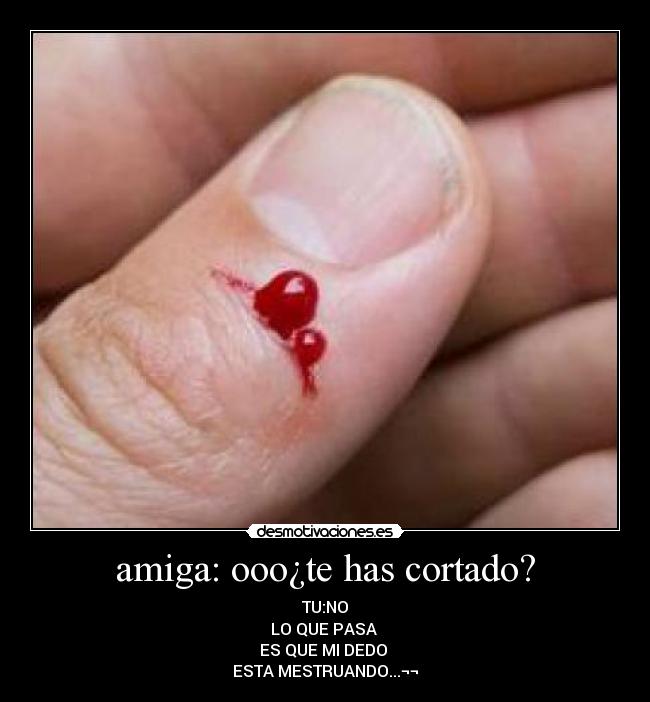 amiga: ooo¿te has cortado? - 