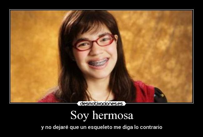 Soy hermosa - y no dejaré que un esqueleto me diga lo contrario