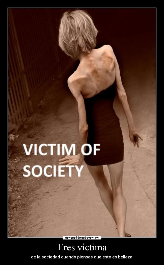 Eres victima - 