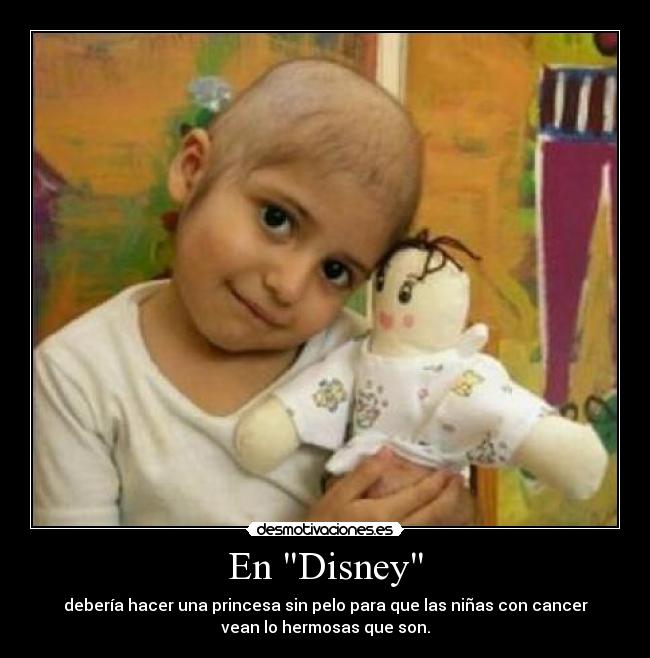 En Disney - debería hacer una princesa sin pelo para que las niñas con cancer
vean lo hermosas que son.