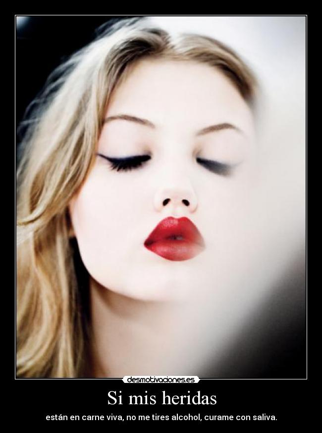Si mis heridas - 