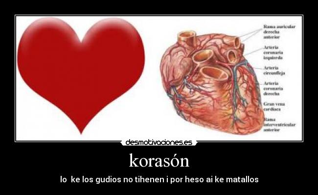 korasón - lo ke los gudios no tihenen i por heso ai ke matallos