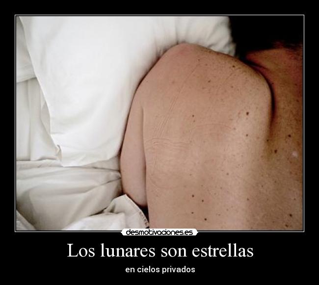 Los lunares son estrellas -