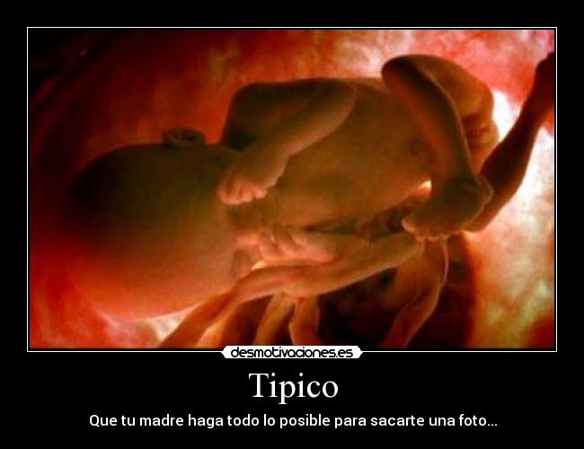 Tipico - 