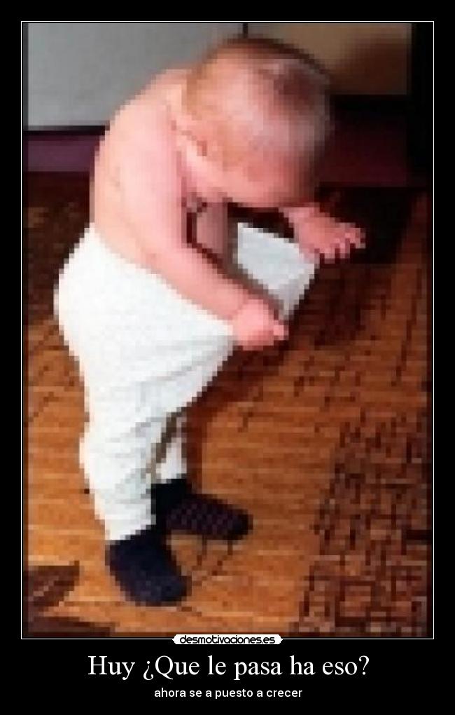 Huy ¿Que le pasa ha eso? - 