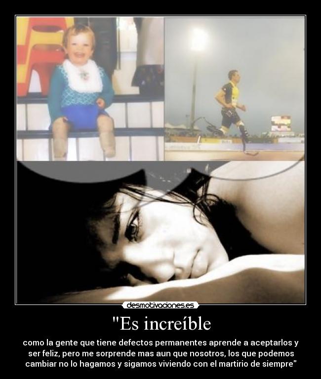 Es increíble - como la gente que tiene defectos permanentes aprende a aceptarlos y
ser feliz, pero me sorprende mas aun que nosotros, los que podemos
cambiar no lo hagamos y sigamos viviendo con el martirio de siempre